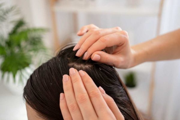 close-up-hands-treating-dandruff-1080x675-1.jpg